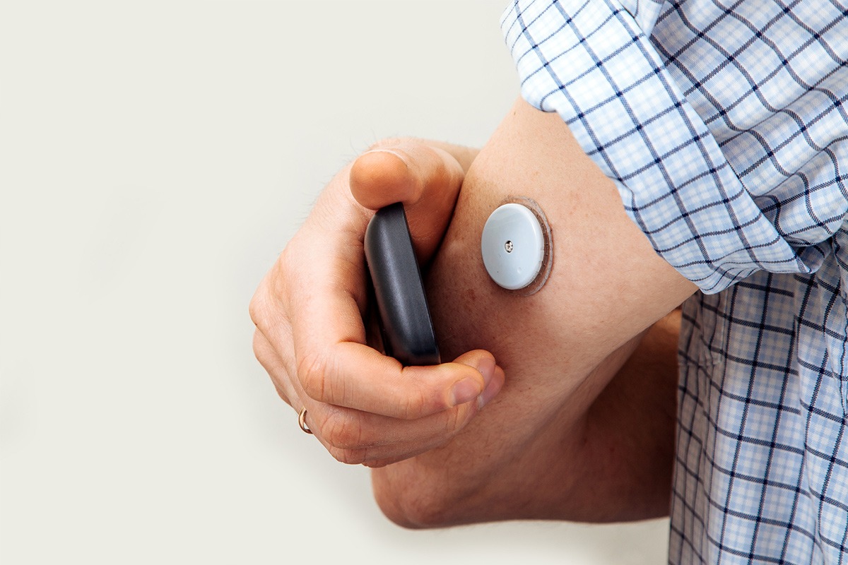 continuous-glucose-monitor-MCG