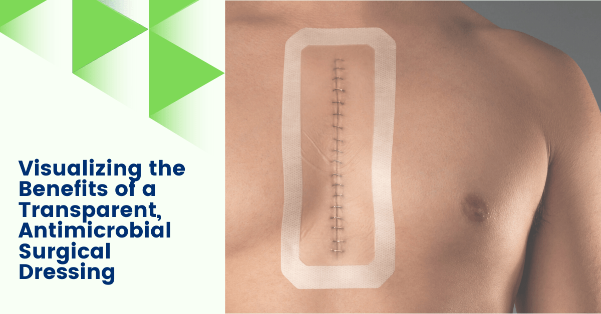 Blog Banner: Visualizing the Benefits of a Transparent, Antimicrobial Surgical Dressing