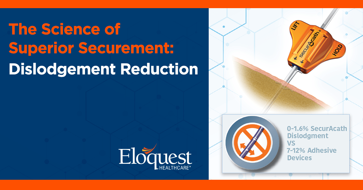 Text: The Science of Superior Securement: Dislodgement Reduction