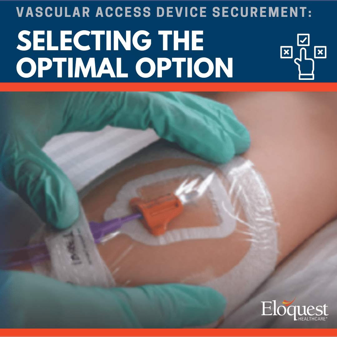 Text: Vascular Access Device Securement Selecting the Optimal Option